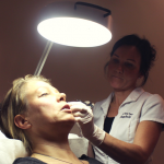 Ett diskret ansiktslyft med Voluma 